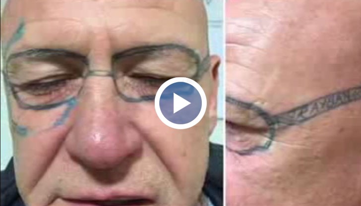 Мъж се събудил с татуирани очила