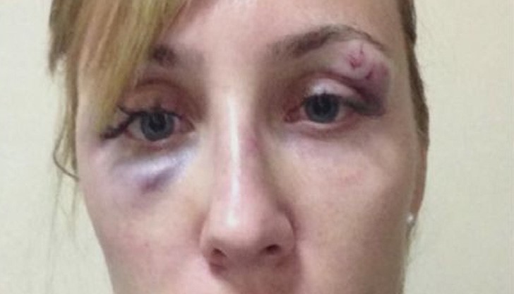 По думите й два часа в хотела отказвали да й окажат помощ По думите й два часа в хотела отказвали да й окажат помощ