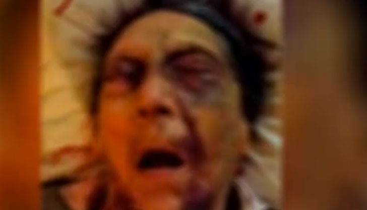 Пребита жена умира, престъпниците – на свобода Пребита жена умира, престъпниците – на свобода