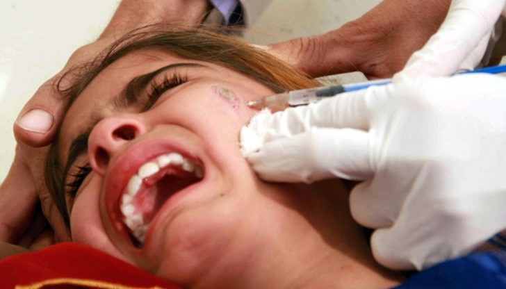 Тази болест е била известна с популярното име „Злото от Алепо“