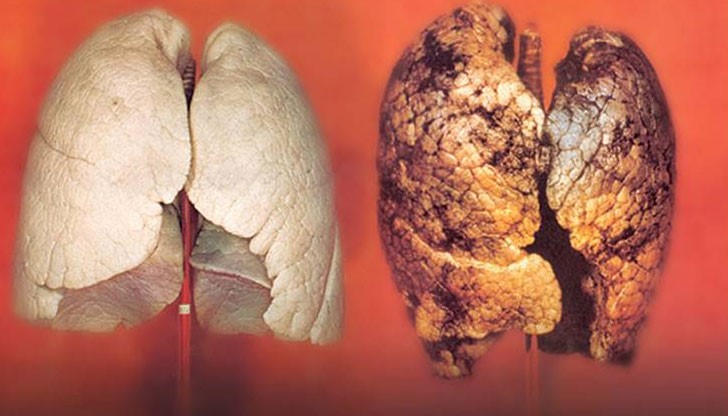 Картините ще показват развалени зъби, трупове, крайници с гангрена, поразени от рак дробове, ослепени очи и т.н.