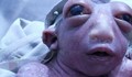 "Бебе чудо" - с половин глава и изцъклени очи