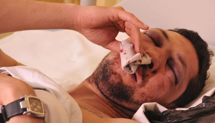 31-годишният Стоян смята, че боят е заради публикациите му, които критикуват местната власт