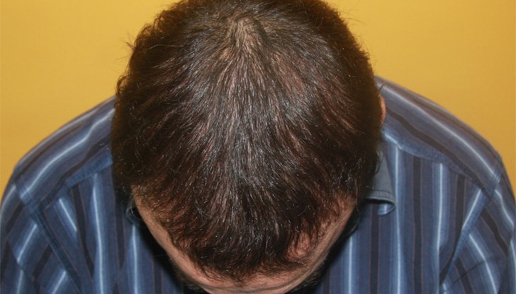 Военните се заинтересували от факта ,че при война индианците вземали скалпа на победените си врагове