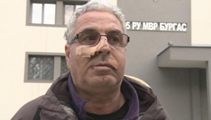 След експертиза ще стане ясно дали младежът ще бъде подведен под оговорност за лека или за средна телесна повреда. След експертиза ще стане ясно дали младежът ще бъде подведен под оговорност за лека или за средна телесна повреда.