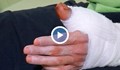 Български лекари трансплантираха палец от крак на ръка