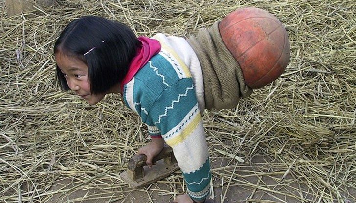 В продължение на 16 години, Циан Хонгянг ходи с помощта на баскетболна топка