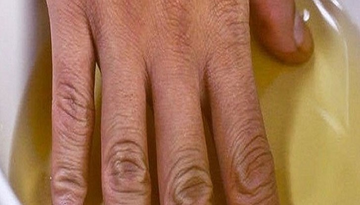 Приложение на ябълковия оцет при проблеми със ставите