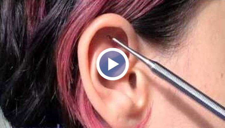 Шен Мен е точка  за масаж, намираща се в ухото