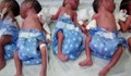 Жена роди изненадващо вместо едно, пет деца