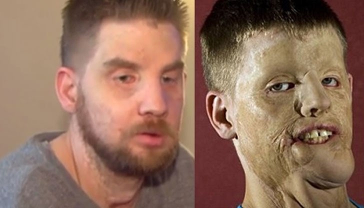 Мич Хънтър, спасява живота на жена, чиято кола се забива в стълб с 10,000 волта напрежение