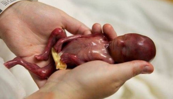 Родителите на Уолтър написаха сърцераздирателно послание, което трябва да се прочете