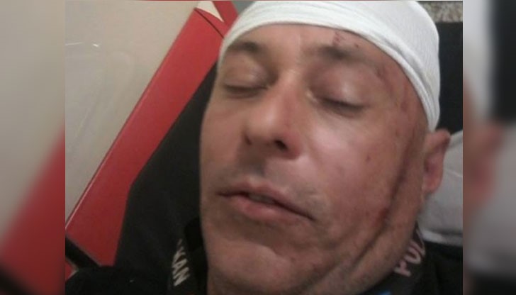 Васил бил бит с бухалки, щанги от цяла тълпа роми