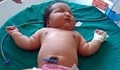 Роди се най-тежкото момиченце в Индия