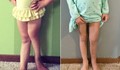 Майка чупи краката на дъщеря си с лечебна цел