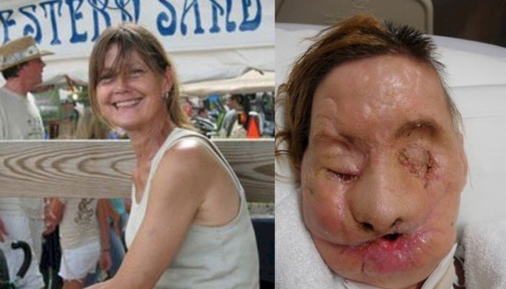 Чарла е атакувана от шимпанзе, пострадва жестоко, до неузнаваемост