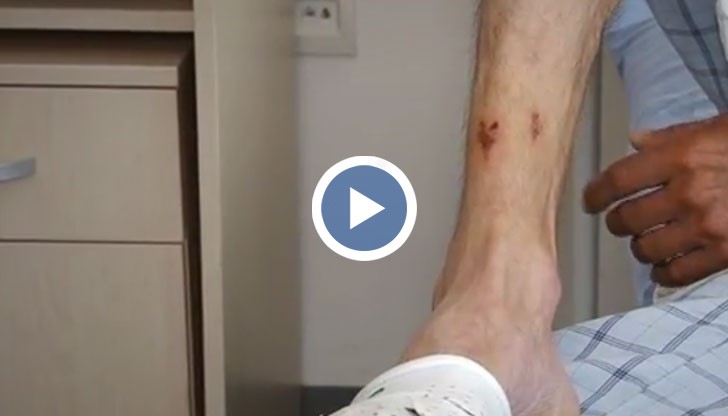 Спасяват го лекарите в Токсикологията, където му поставят противозмийски серум