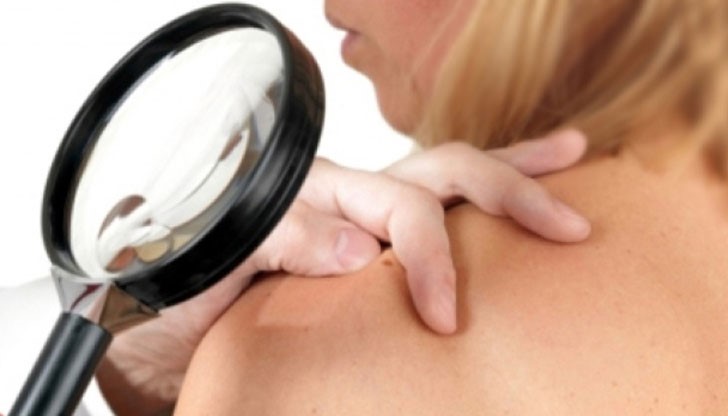 Национална кампания за профилатика на рака на кожата Национална кампания за профилатика на рака на кожата