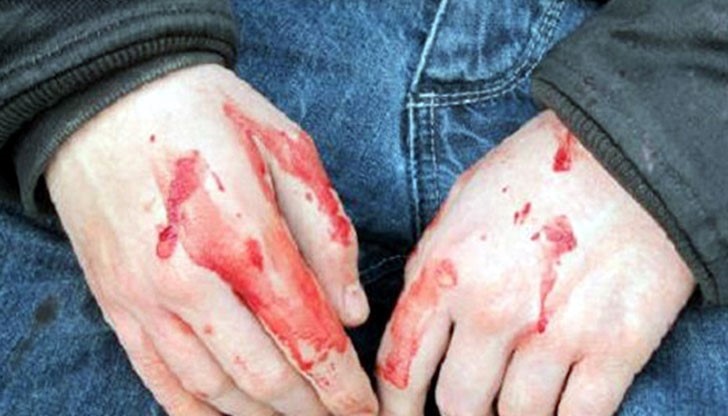 Полицията е започнала разследване по сигнал за нанесена телесна повреда при спречкване пред дискотека в Русе