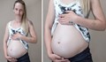 Тази жена е "бременна" вече 25 месеца