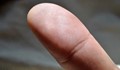 Болниците започват да събират пръстови отпечатъци