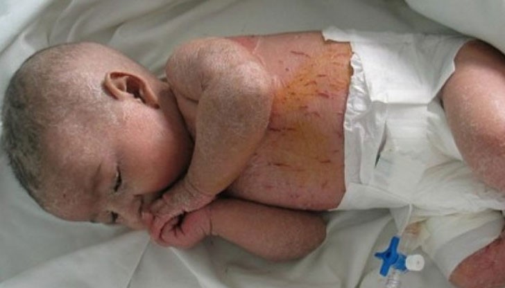 Детето изпитва адски болки и затова го упояват