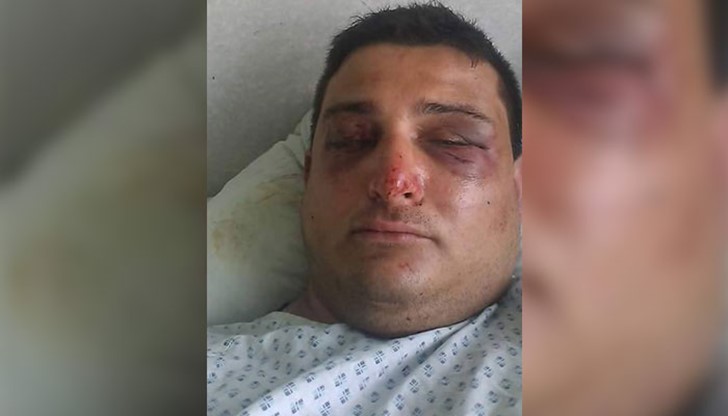 До кога ще търпим да ни бият пред собствените ни къщи? До кога ще търпим да ни бият пред собствените ни къщи?