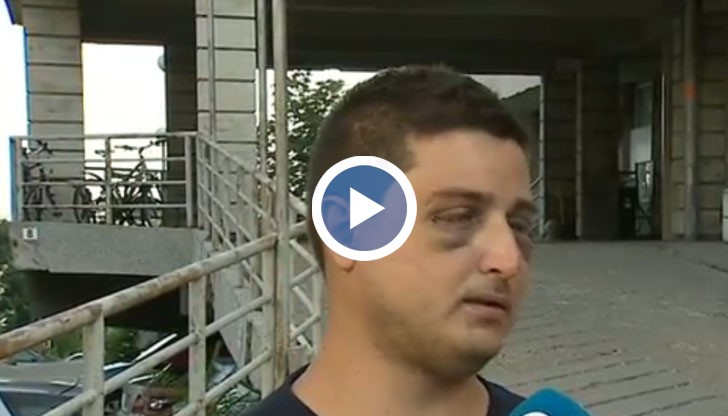 Той е все още в болница с наранявания по главата