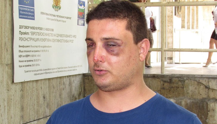 6-7 души със сопи и пръчки прескочили оградата на къщата и пребили русенеца