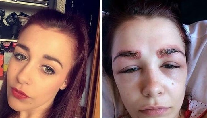 19-годишната Поли Смит е искала по-красиви вежди, но нещата се объркват жестоко