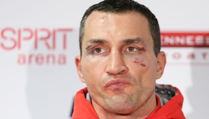 Срещата с Фюри беше отложена, след като англичанинът контузи глезена си