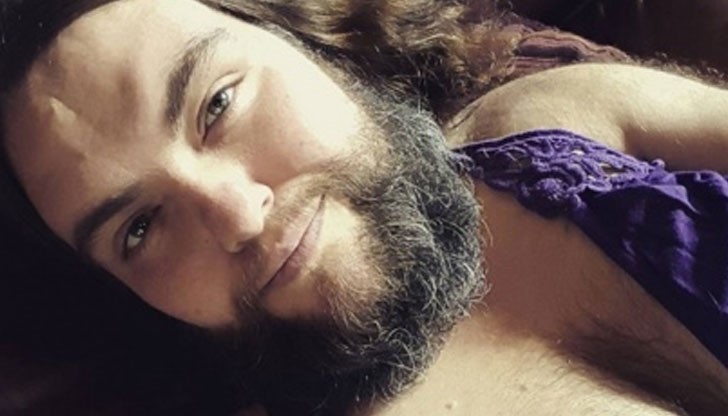 Роуз Гейл е 39-годишна жена, която поради мистериозни медицински причини има плътно окосмяване по лицето си