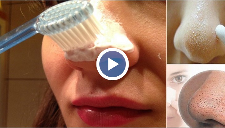 Как бързо да премахнете черните точки