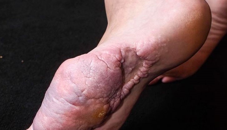 Надявам се един ден да водя нормален живот, споделя момичето