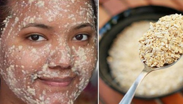 Тъмните петна се появяват не само по кожата на лицето, а по ръцете, както и по други части на тялото