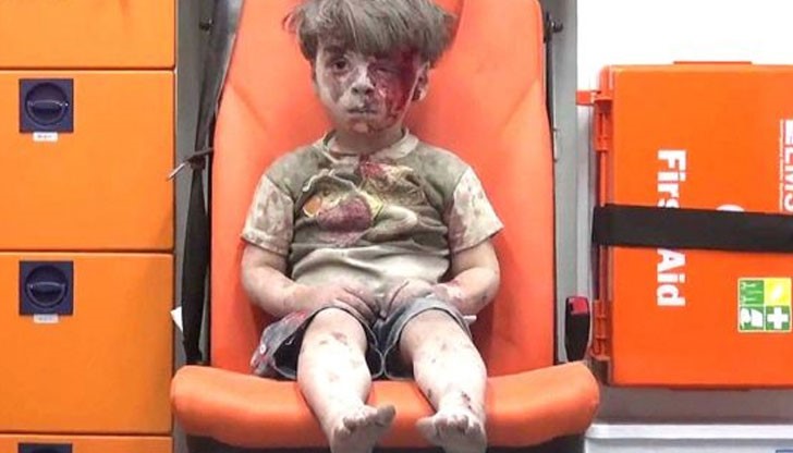 Братчето на 5-годишния Омран Дакнийш, който замисли целия свят почина от раните си Братчето на 5-годишния Омран Дакнийш, който замисли целия свят почина от раните си