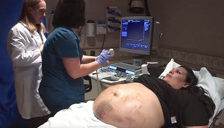 Лекарите ги очаквала много по-приятна изненада