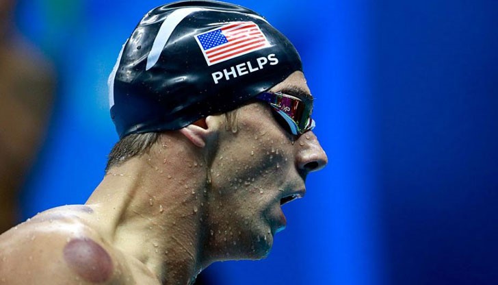 Сигурно сте забелязали червените кръгове по гърба и рамената на плувеца