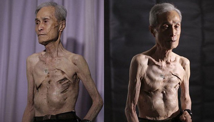 Тялото на 86-годишния мъж е покрито с белези, които пресичат кожата му вече 70 години