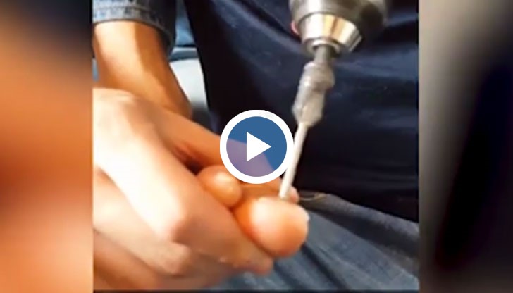 Човекът явно не е намерил друг начин за лечение и е предприел тази брутална мярка