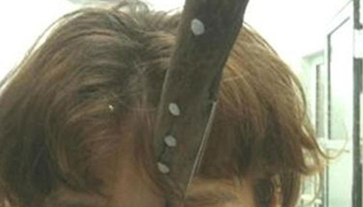 11-сантиметровото острие пронизва главата на момичето, но то оцелява по чудо