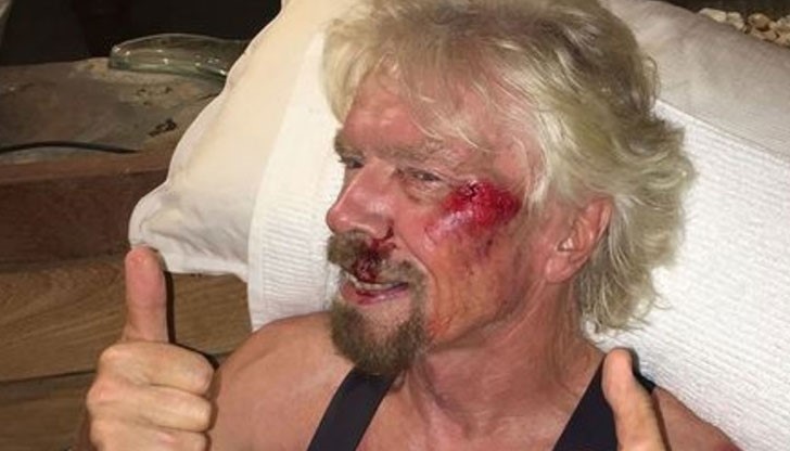 Собственикът на „Върджин Груп” Ричард Брансън падна от велосипед, каската го спасила от тежки наранявания