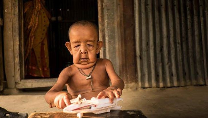 Приличаше на извънземно, казва майката на детето