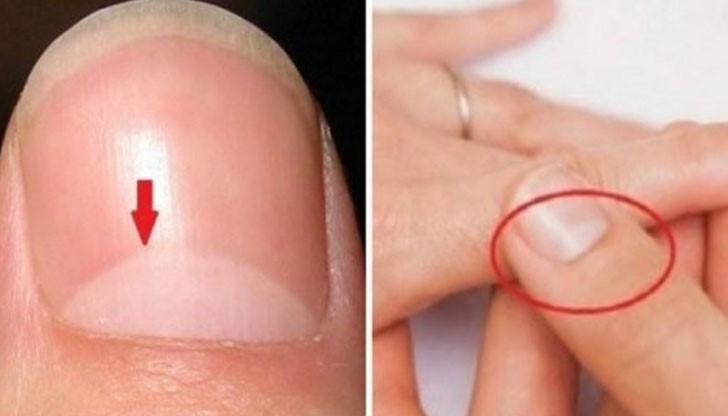 Погледни ноктите си: виждате ли яркия полумесец в основата?