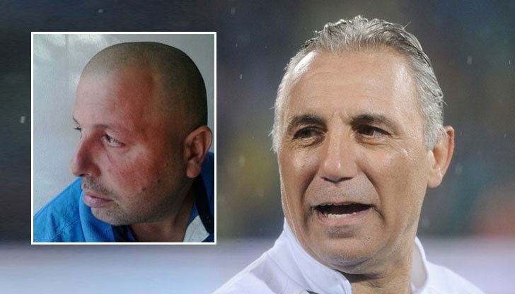 Шофьорът Петър е в шок след побоя, който му нанесъл Стоичков Шофьорът Петър е в шок след побоя, който му нанесъл Стоичков