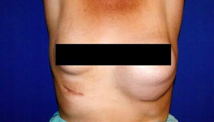 Жената станала поредната жертва на д-р Петър Ким, съден няколко пъти за лекарска небрежност