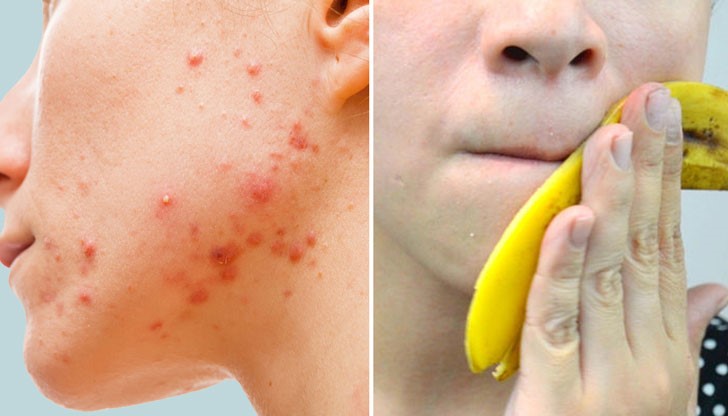 Опитайте още днес и ще останете изумени! Опитайте още днес и ще останете изумени!