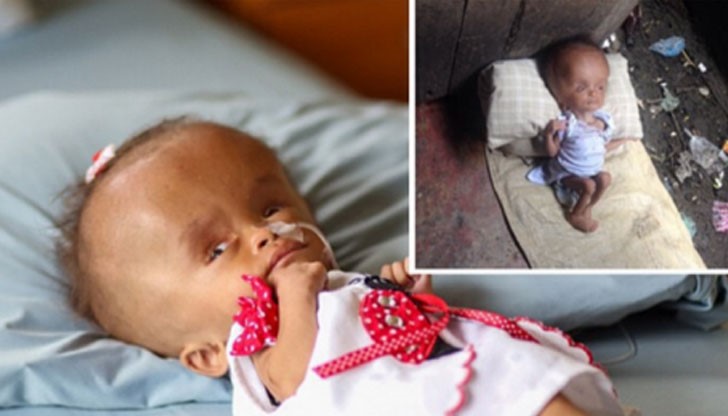 Майка й се опитала да прекъсне бременността си с отрова