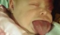 Бебе се роди с език на възрастен човек