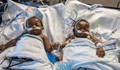 След 18-часова операция лекари разделиха сиамски близнаци